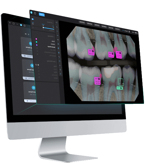 Pearl AI-assisted X-ray diagnostics