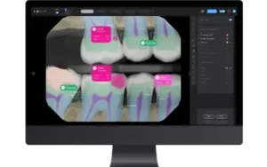 demo of how pearl AI scanning tool enhances improved dental imaging technology