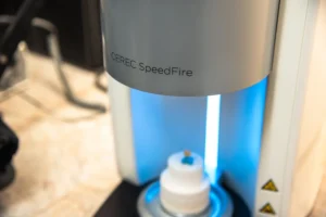 Photo of medical equipment, the Cerec Speedfire