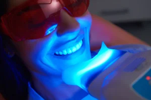 Teeth Whitening In Vancouver WA from Lewis Family and Implant Dentistry