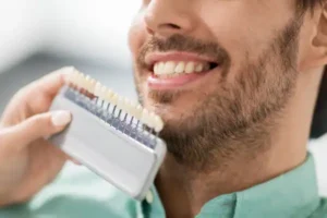 Close up of dentist with veneer samples choosing which shade to use for male patients teeth.